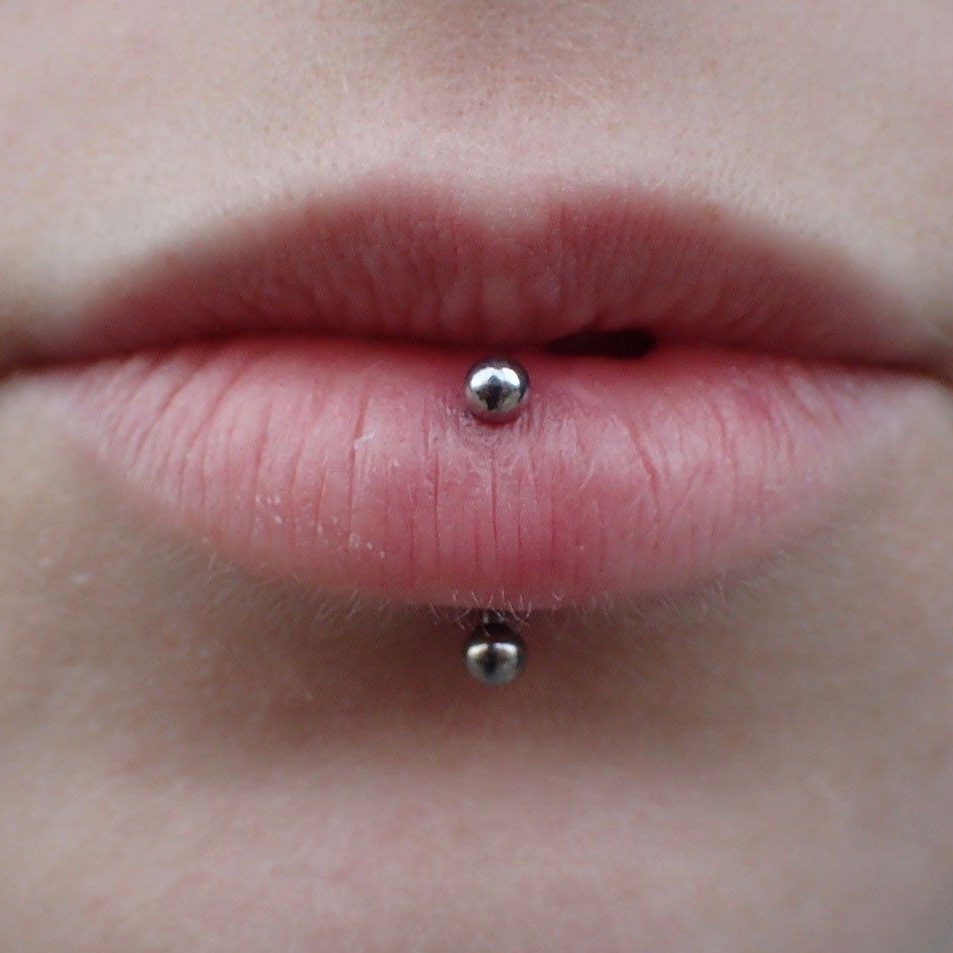 Can a vertical labret damage teeth