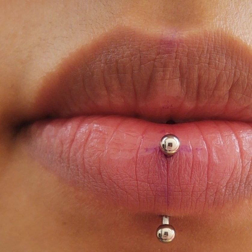 Can a vertical labret damage teeth